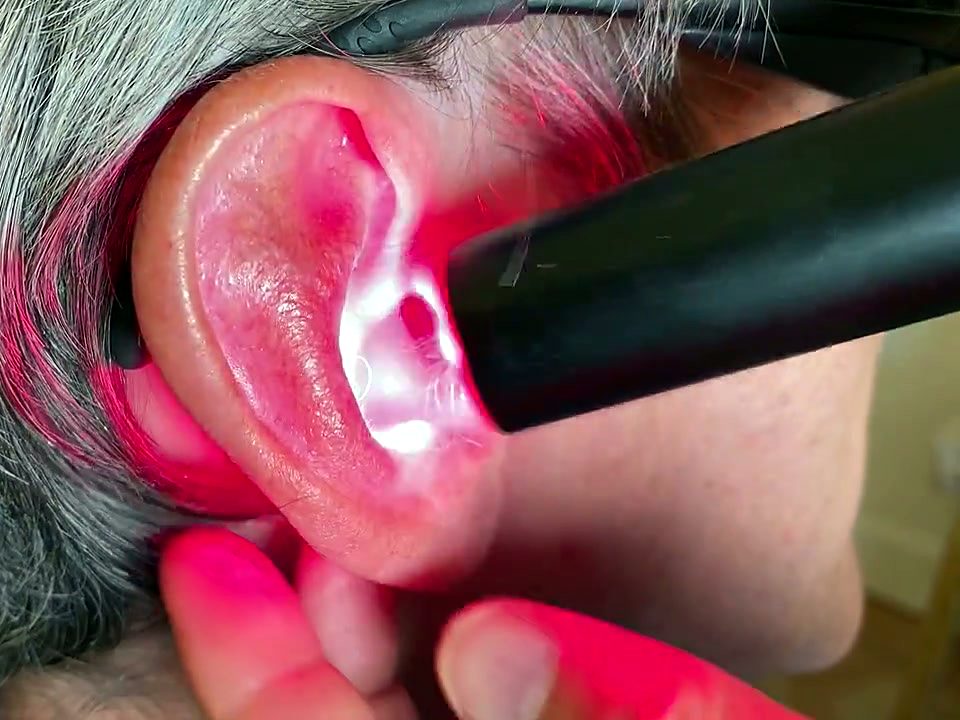Le Laser Pen appliqué contre l'oreille, la main du praticien maintient le pavillon