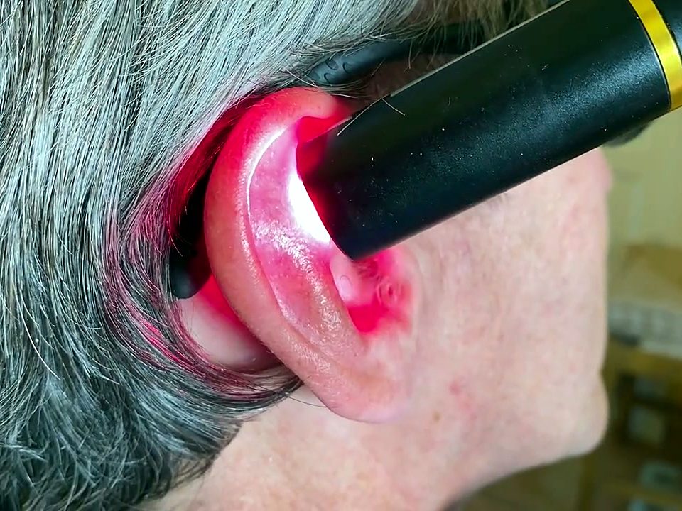 Le Laser Pen posé sur un point du pavillon de l'oreille, la lumière rouge diffuse dans le cartilage