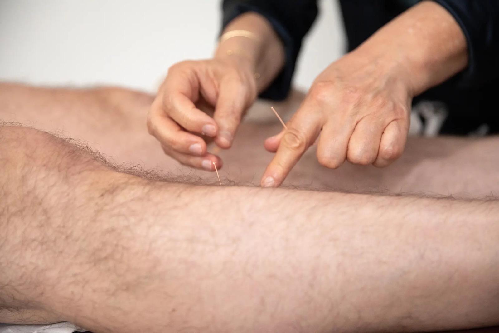 Needle placement commented on by Dr Nadia Volf during a Masterclass